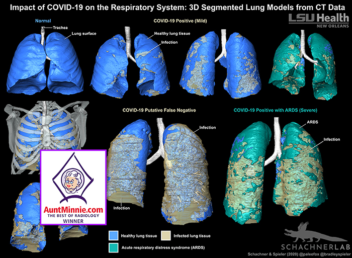 LSU Health Best 2020 Radiology Image